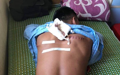 Đi ăn đêm, nam thanh niên bất ngờ bị đánh chém rồi cướp tài sản