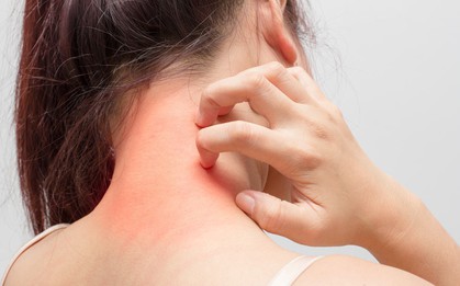 Không khí khô hanh của mùa này rất dễ khiến bạn gặp phải nhiều bệnh vặt và đây là một số cách phòng tránh