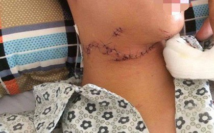 Bắc Giang: Đi chợ đêm, một phụ nữ bị cướp cứa cổ tử vong