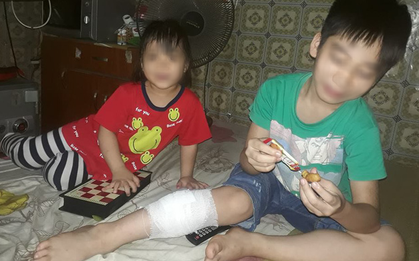 Đàn chó tấn công 2 học sinh tiểu học ở Hà Nội, một bé nhập viện vì bị cắn nhiều phát vào chân