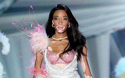 Người mẫu bạch biến đăng đàn giải thích khi bị nghi "vô ơn" với Tyra Banks sau "Next Top Mỹ"