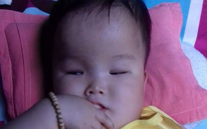 Tâm sự nghẹn lòng của mẹ 9x có con bị não úng thủy: Sợ một ngày con sẽ rời xa mẹ