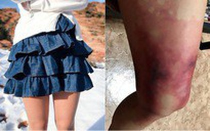 Thời trang “phang” thời tiết, cô gái diện váy ngắn giữa trời đông giá rét và nhận cái kết không thể nào đắng hơn
