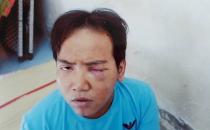 Vụ bảo vệ tổ dân phố sát hại bé trai 6 tuổi ở Sài Gòn: Kẻ gây án bị tâm thần phân liệt thể hoang tưởng