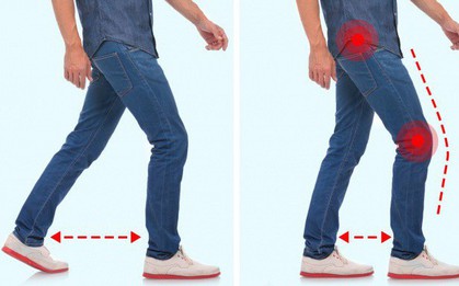 7 dáng vẻ khi đi bộ cảnh báo bạn đang bị bệnh