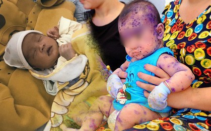 Đau lòng trước những hậu quả trẻ sơ sinh gánh phải khi người lớn cuồng phương pháp "thuận tự nhiên"