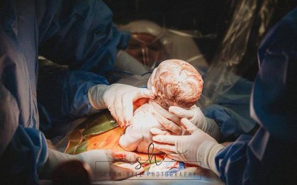 Nín thở xem khoảnh khắc nữ y tá tự tay nhấc con ra khỏi bụng mẹ trong ca sinh mổ của chính mình