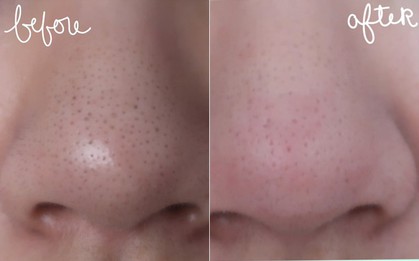 Chỉ với Vaseline và toàn đồ đơn giản, đây là cách khiến mũi láng bóng mịn màng được nhiều cô nàng truyền tai nhau