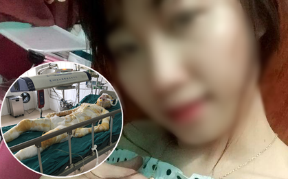 Cô gái bị tẩm xăng thiêu sống trong lúc ngủ sức khỏe chuyển biến xấu, mất nhận thức, hoàn toàn bất tỉnh