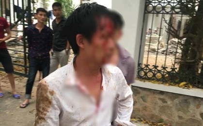 Vĩnh Phúc: Đến điểm hẹn lấy món nợ sau nhiều lần đòi, nam thanh niên bị nhóm người lạ đánh nhập viện
