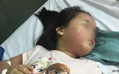 Thực hư vụ bé gái 5 tuổi phải nhập viện Bạch Mai khẩn cấp nghi do ngộ độc trà sữa