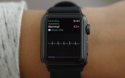 Apple Watch vừa lập công cứu mạng một người phụ nữ