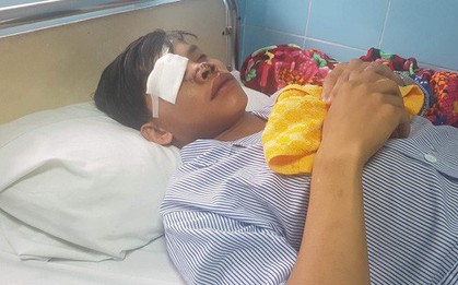 Nam thanh niên bị chém bể mắt, đứt mũi vì "hỗn láo" với đàn anh