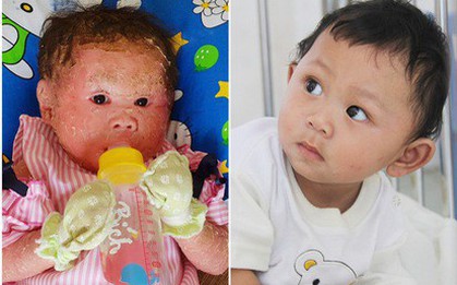 Cuộc sống của bé Ngọc Bích và nhiều em nhỏ khác ở Trung tâm Bảo trợ xã hội