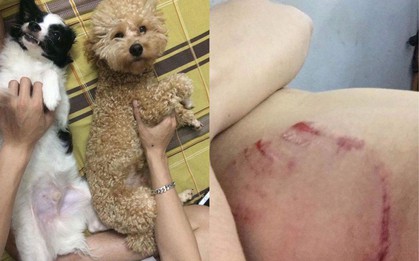 Tấm gương sen dũng cảm: Thanh niên đứng im cho Pitbull cắn để bảo vệ 2 chú chó nhỏ