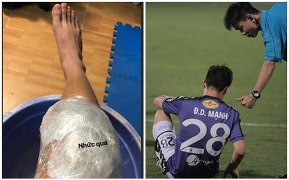 Chân chườm bịch đá, Duy Mạnh than nhức sau cú phạm lỗi của cầu thủ HAGL