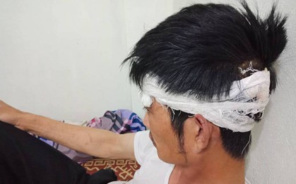 Tài xế taxi bị đánh gửi đơn đề nghị cơ quan chức năng làm rõ, xử lý người hành hung mình