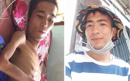 Thanh niên hồi phục thần kỳ sau khi mắc hàng loạt bệnh hiểm nghèo nhờ tinh thần lạc quan