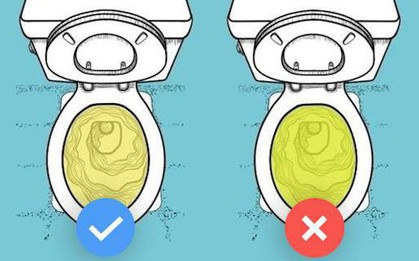 6 dấu hiệu cảnh báo bệnh ung thư bàng quang mà bạn không nên bỏ qua