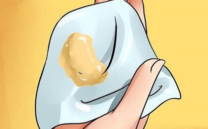 5 dấu hiệu cảnh báo bệnh ung thư âm đạo mà con gái không nên chủ quan xem thường