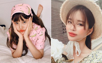 Hết mụn rồi lại đến thâm, bạn nhất định tránh xa 5 sai lầm tai hại này để da mịn màng không tì vết
