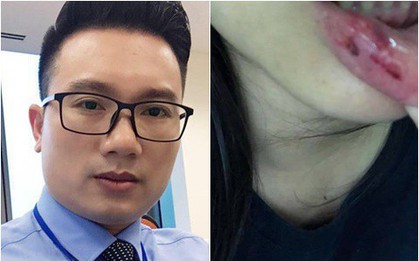 Bố nữ sinh 15 tuổi cho biết con gái bị anh rể Minh Tiệp bạt tai sau khi tắm quá lâu, không có chuyện bạo hành thường xuyên