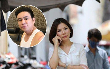Vụ bác sĩ Chiêm Quốc Thái bị giang hồ chém ở trung tâm Sài Gòn: Bắt giữ nghi can chính là người vợ cũ