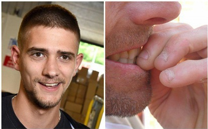 Thói quen cắn móng tay mọi lúc mọi nơi khiến ông bố 2 con suýt mất mạng vì điều này