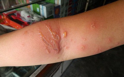 Những mối nguy tiềm ẩn vào mùa du lịch biển cần phải biết để phòng tránh