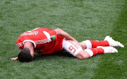 "Messi của nước Nga" nguy cơ chia tay World Cup 2018 ngay sau trận khai màn