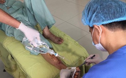 Bác sĩ rùng mình cứu bàn chân hoại tử do bệnh nhân tự chữa đái tháo đường
