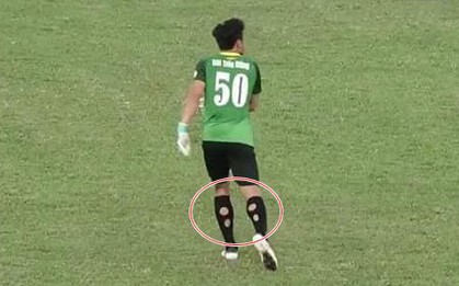 Thủ môn Bùi Tiến Dũng cũng đi tất thủng thi đấu giống Neymar