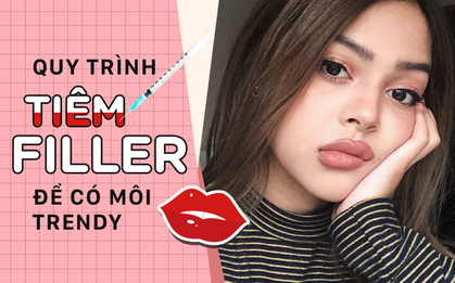Quy trình tiêm filler để có một đôi môi "tều" chuẩn sexy
