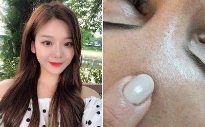 Nếu đang sử dụng các sản phẩm có chứa acid thì bạn nên dừng lại ngay nếu gặp phải 4 dấu hiệu sau