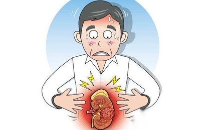 6 thói quen tưởng vô hại nhưng lại có thể dẫn đến nguy cơ mắc bệnh ung thư thận