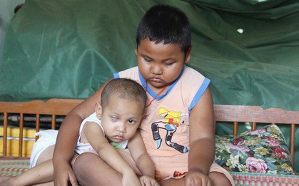 Bé gái 3 tuổi bị ung thư mắt, bố mẹ chở phân bò dành dụm từng đồng tìm lại ánh sáng cho con trong vô vọng