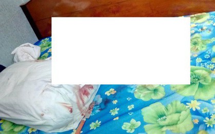 Nghi vấn nữ bác sĩ bị người yêu cũ sát hại bất thành