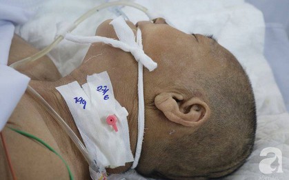 Bán nhà cho con cưới vợ, bà mẹ nghèo bị tai nạn giao thông không tiền chữa trị phải cắt cụt chân hiện đang lâm nguy