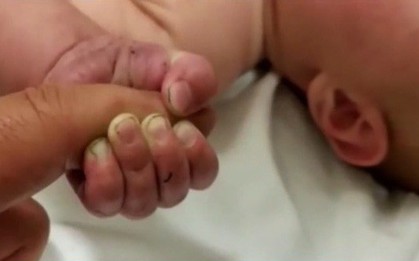 Em bé 5 tháng tuổi sống sót kỳ diệu sau 9 tiếng bị vùi chôn trong rừng