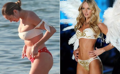 Bị chê là bụng phệ sồ sề sau sinh, siêu mẫu Candice Swanepoel có cách đáp trả khiến "hater" câm nín
