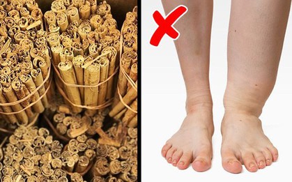Các loại thực phẩm và đồ uống giúp cơ thể thoát khỏi bị giữ nước