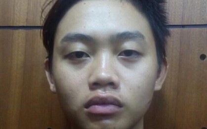TP. HCM: Thanh niên 19 tuổi rủ cô gái vào khách sạn "vui vẻ" rồi chích điện, cưỡng đoạt tài sản