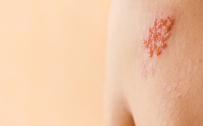 Những dấu hiệu cảnh báo trái tim của bạn đang "bất ổn"