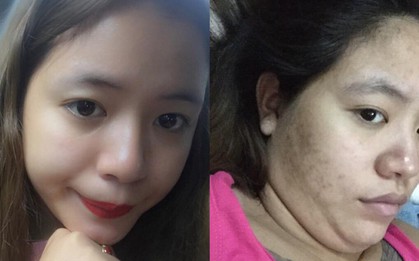 Tăng 10kg sau sinh không giảm, cơ thể sồ sề mặt chi chít vết thâm, bà mẹ trẻ tuyên bố: "Gái một con trông mòn con mắt" là giả dối!