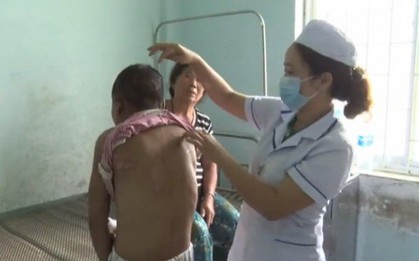 Người làm thuê tố bị dùng kìm bẻ răng và dao lam rạch mặt: Chủ nhà khai gì?