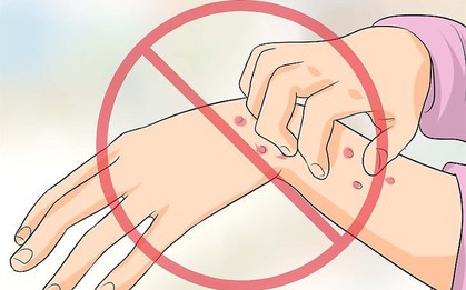 Ngứa da điên cuồng trong mùa hè, có thể là do bạn đã mắc phải một trong các bệnh sau