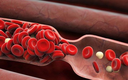 Những triệu chứng đông máu có thể dẫn đến đột quỵ mà bạn không nên phớt lờ