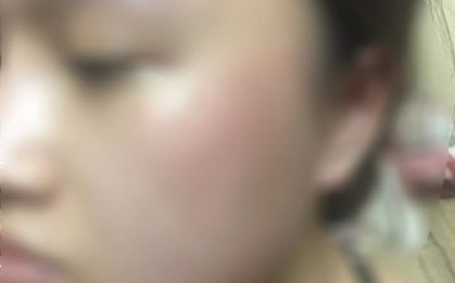 Một nữ sinh thuê trọ bị nam chủ nhà tát vào mặt sau thắc mắc: "Tại sao thu tiền bọn em rồi mà cuối tháng còn chưa đóng tiền điện?"