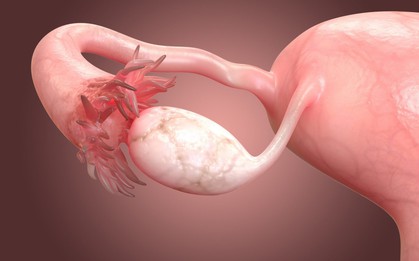 Một hiện tượng lạ vô cùng nguy hiểm với nữ giới mà không phải ai cũng biết