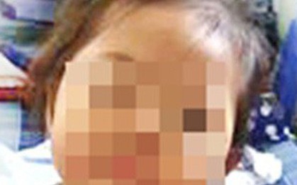 Tiêm ngừa bị nhiễm trùng, bé gái 32 tháng tuổi phải phẫu thuật đùi trái 3 lần